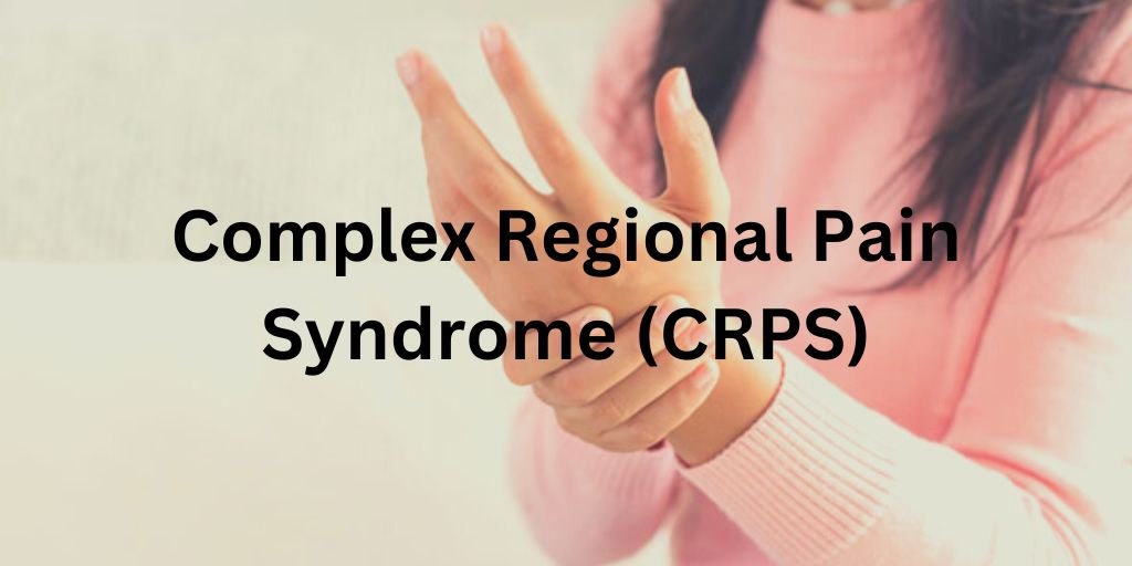 Complex regional pain syndrome (CRPS) - Treatment Options for CRPS
