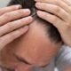 5 Effective Ways to Reclaim Your Hairline